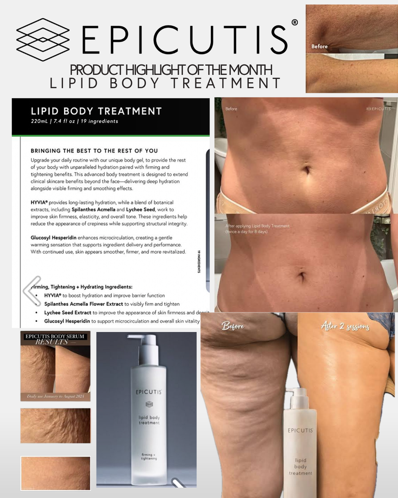 EPICUTIS® Lipid Body Treatment