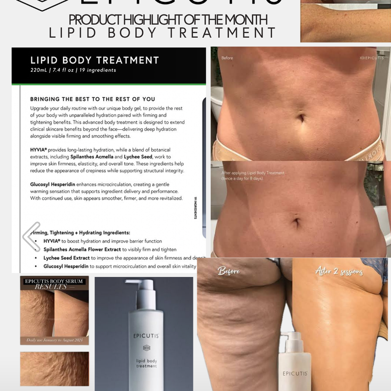 EPICUTIS® Lipid Body Treatment