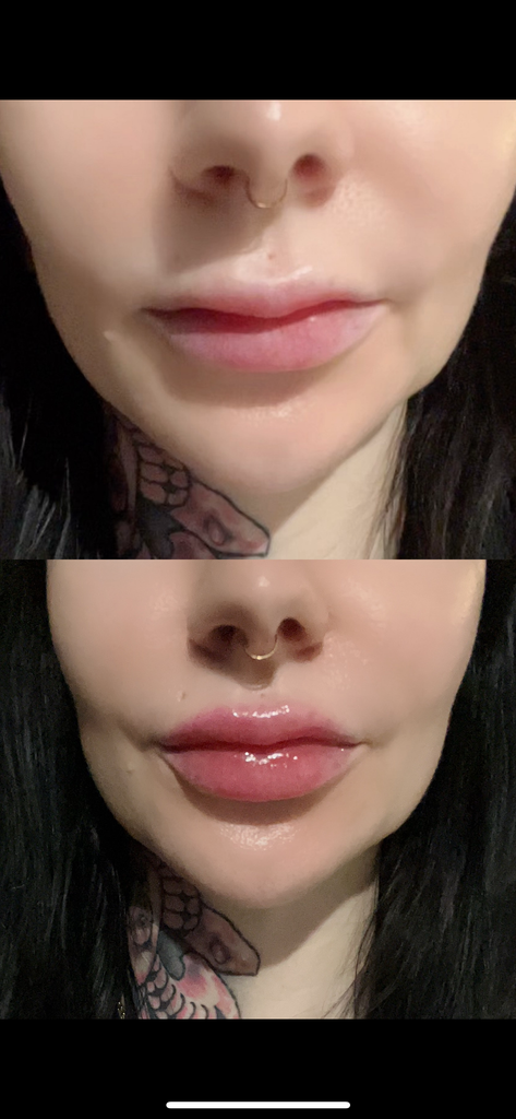 XL LIP PLUMP 💋